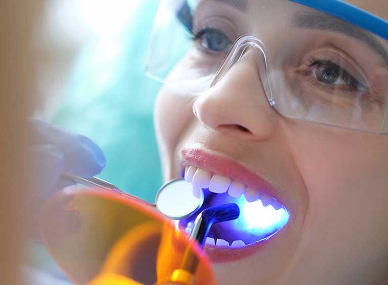 Dental-Sealants-banner-sm