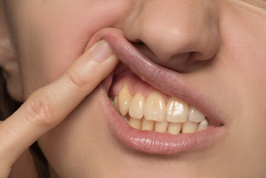3 reasons why you might have yellow teeth