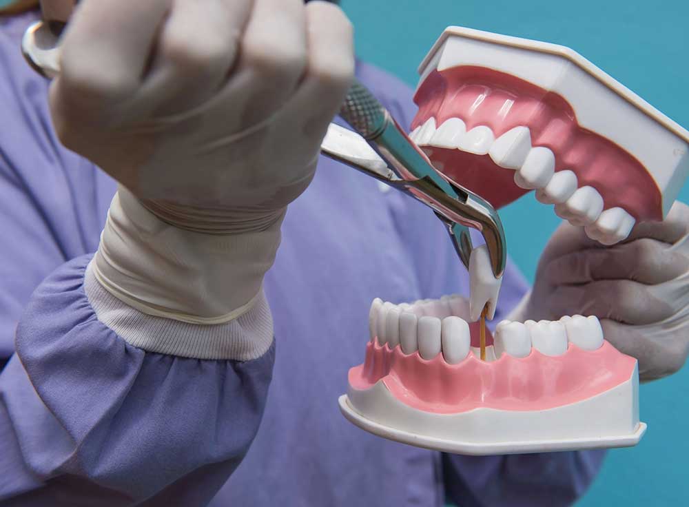 tooth-Extractions-banner