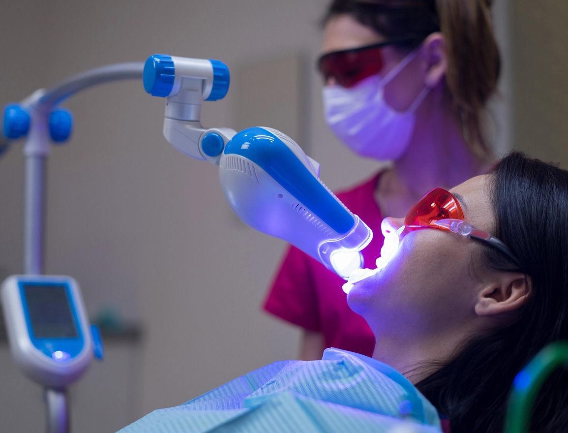 Laser on teeth